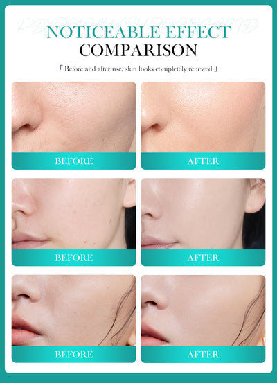 Melao Cross-Border Spot Pdrn Hyaluronic Acid Moisturizing Cream Double Moisture-Locking and Nourishing Skin Facial Moisturizing Cream