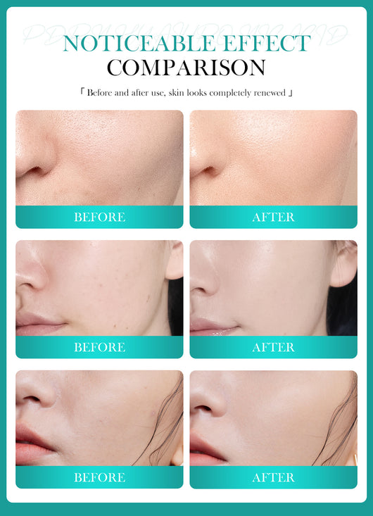 Melao Cross-Border Spot Pdrn Hyaluronic Acid Moisturizing Cream Double Moisture-Locking and Nourishing Skin Facial Moisturizing Cream